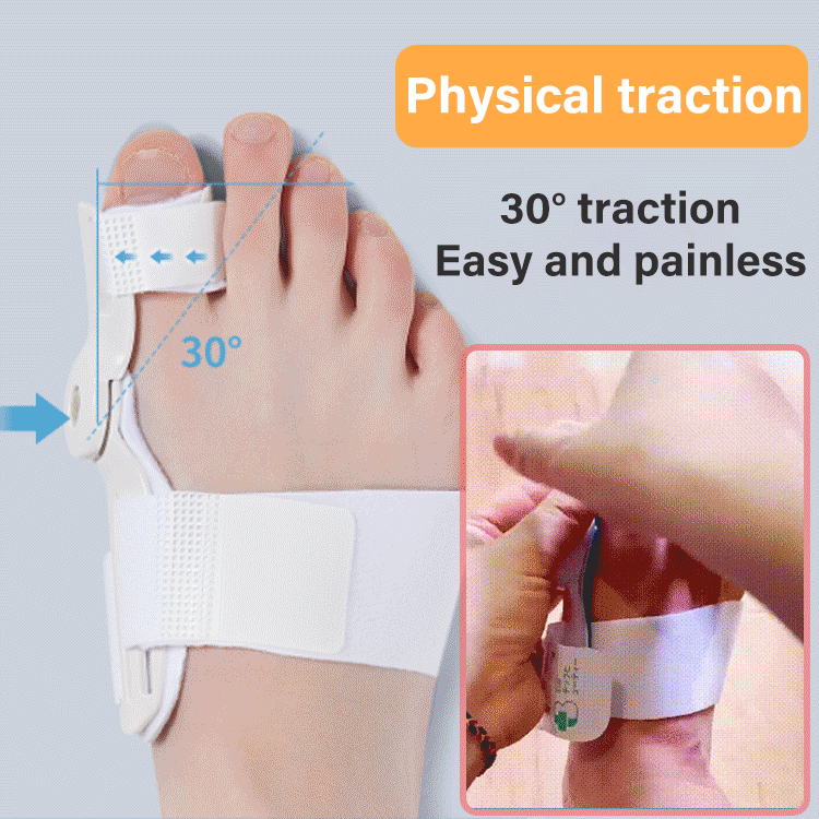 【Kúp 1, získaj 1 zadarmo】Korektor prstov, koriguje deformity prstov, hallux valgus, kladivkové prsty a ďalšie problémy! (Vhodné pre osoby s hmotnosťou 40-80 kg)